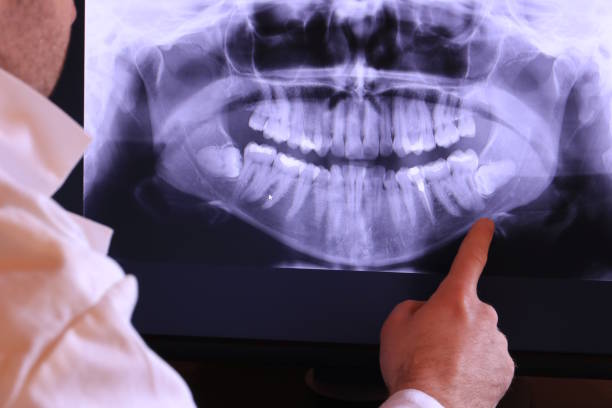 Best Emergency Broken Tooth Repair in Bardstown, KY