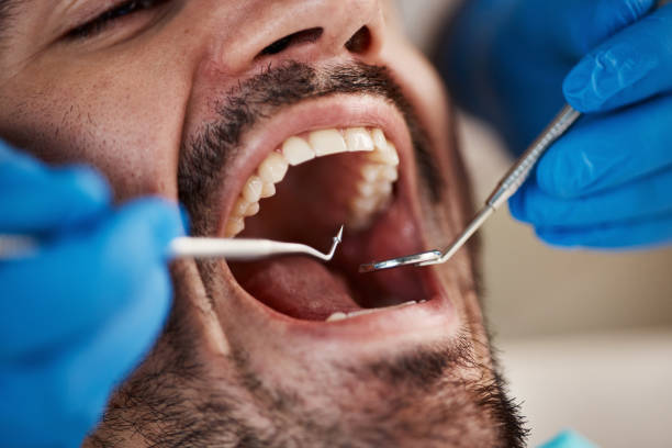 Best Walk-In Emergency Dentist in Bardstown, KY